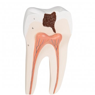 Apatinio žogaus krūminio danties su dviguba šaknimi ir įdubomis modelis, 2 dalys 7