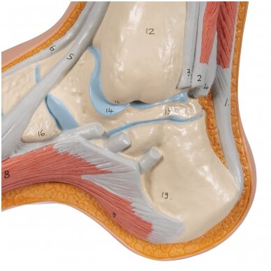 Gaubtos pėdos (Pes Cavus) modelis 7