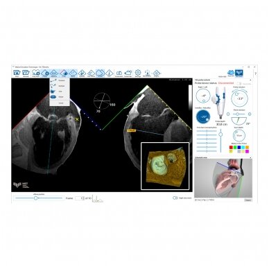 MrTEEmothy® eksperto transezofaginės echokardiografijos (TEE) simuliatorius 3